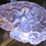 若年性パーキンソン病と成人期以降のパーキンソン病の違い