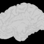 パーキンソン病ではなかった場合に一体どのような病気が考えられるかについて解説